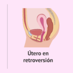 Cómo las retrogradaciones afectan a las relaciones