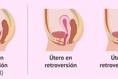como las retrogradaciones afectan a las relaciones